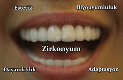 Zirkonyum Dişler Gebze